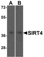 SIRT4 Polyclonal Antibody