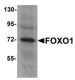 FOXO1 Antibody in Western Blot (WB)