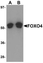 FOXO4 Antibody in Western Blot (WB)