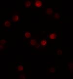 Gemin 2 Antibody in Immunocytochemistry (ICC/IF)