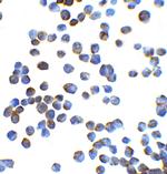 ZEB1 Polyclonal Antibody