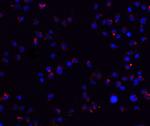 ZEB2 Polyclonal Antibody