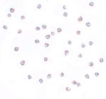 FREM2 Polyclonal Antibody