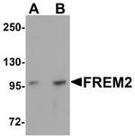 FREM2 Antibody in Western Blot (WB)