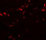 TCTN1 Polyclonal Antibody