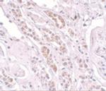 TCTN1 Antibody in Immunohistochemistry (IHC)