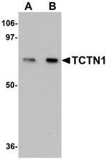 TCTN1 Antibody in Western Blot (WB)