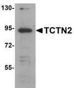 TCTN2 Polyclonal Antibody