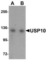 USP10 Antibody in Western Blot (WB)