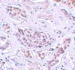 ATG3 Antibody in Immunohistochemistry (IHC)