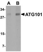 ATG101 Antibody in Western Blot (WB)