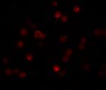 CABP7 Antibody in Immunocytochemistry (ICC/IF)