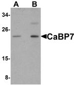 CABP7 Antibody in Western Blot (WB)