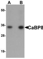 CaBP8 Polyclonal Antibody