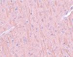 CCDC106 Polyclonal Antibody