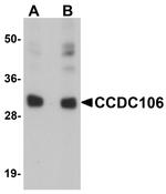 CCDC106 Antibody in Western Blot (WB)