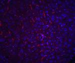 AFP Polyclonal Antibody