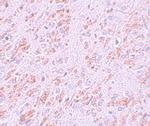 VENTX Polyclonal Antibody