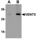 VENTX Antibody in Western Blot (WB)