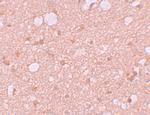 SESTD1 Antibody in Immunohistochemistry (IHC)