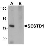 SESTD1 Antibody in Western Blot (WB)