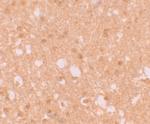 TRIM71 Antibody in Immunohistochemistry (IHC)