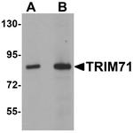 TRIM71 Antibody in Western Blot (WB)