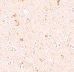 SH3RF2 Polyclonal Antibody