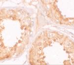 YBX2 Polyclonal Antibody