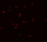 NOD3 Polyclonal Antibody