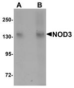 NOD3 Antibody in Western Blot (WB)