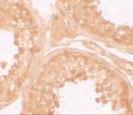 NALP9 Polyclonal Antibody