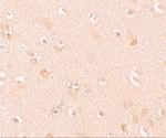 NALP5 Polyclonal Antibody