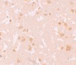 NALP7 Polyclonal Antibody