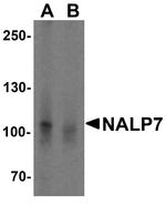 NALP7 Antibody in Western Blot (WB)