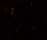 BANP Antibody in Immunohistochemistry (IHC)