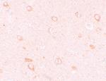 CIITA Polyclonal Antibody