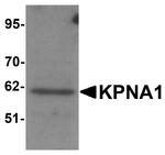 KPNA1 Antibody in Western Blot (WB)