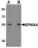 KPNA4 Antibody in Western Blot (WB)
