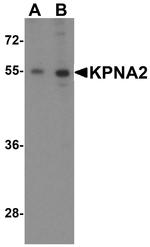 KPNA2 Antibody in Western Blot (WB)