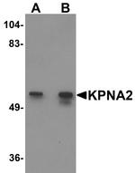 KPNA2 Antibody in Western Blot (WB)