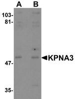KPNA3 Antibody in Western Blot (WB)