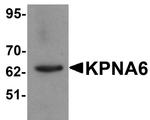 KPNA6 Antibody in Western Blot (WB)