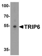 TRIP6 Antibody in Western Blot (WB)