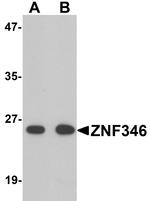 ZNF346 Polyclonal Antibody
