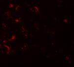 AXIN1 Polyclonal Antibody