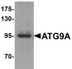 ATG9A Antibody in Western Blot (WB)
