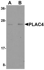 PLAC4 Antibody in Western Blot (WB)