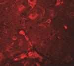 APBA2 Antibody in Immunohistochemistry (IHC)