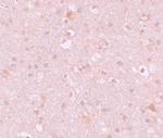CXXC4 Polyclonal Antibody